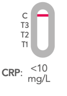 Test Result Negative