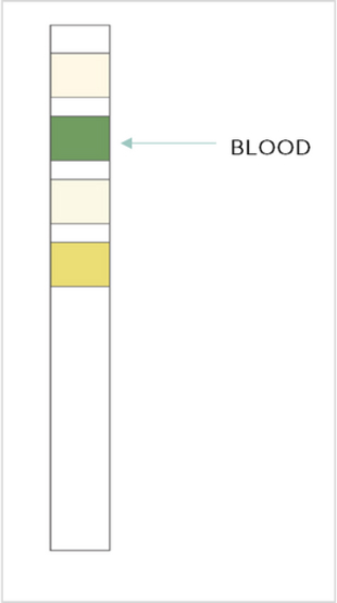 Test Result Positive Blood