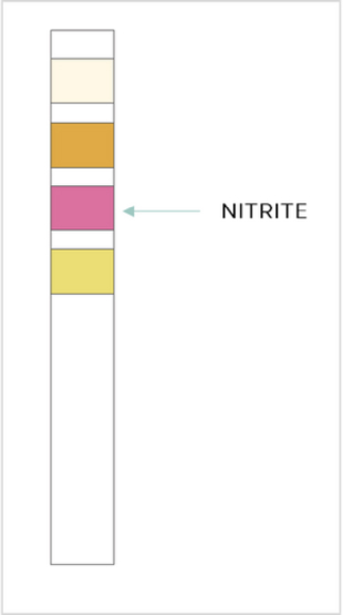 Test Result Positive Nitrite