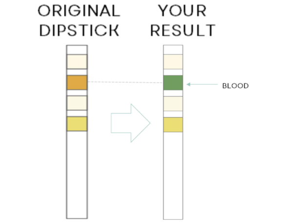 Test Results Positive Blood