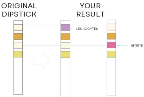 Test Results Positive Leukocytes or/and Nitrites