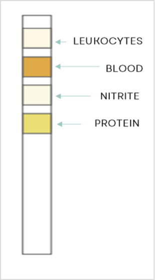 Test Result Negative